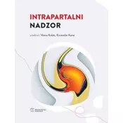 Intrapartalni nadzor