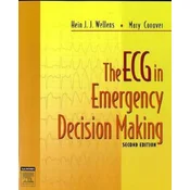 The ECG in Emergency Decision Making