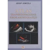 ATLAS TRANSEZOFAGUSNE EHOKARDIOGRAFIJE