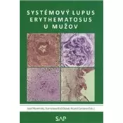 Systemovy lupus erythematosus u muzov