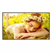 LG 75UL5Q-E Signage Display 75inch ADS UHD 500cd/m2 1,200:1 24/7 WebOS 6.1 WiFi