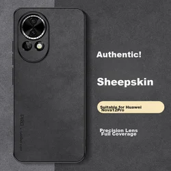 Shangsu Maska za mobilni telefonHuawei Nova 12 Pro / Huawei Nova 12 Ultra, Crna