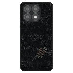 ULTIMATE CASE za Honor X8a - SCRATCH