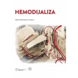 Hemodijaliza