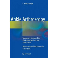 Ankle Arthroscopy