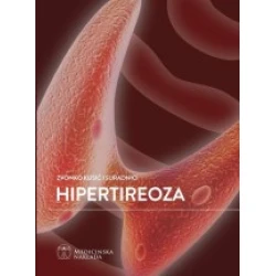 Hipertireoza