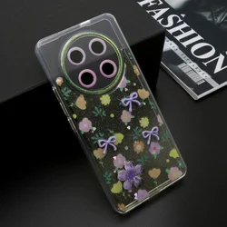 Futrola whisper za honor x9c/magic 7 lite zuta ( F123956 )