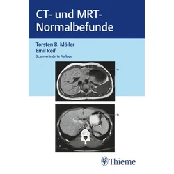 CT und MRT Normalbefunde