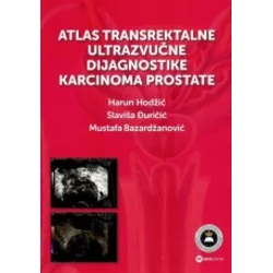 Atlas transrektalne ultrazvučne dijagnostike karcinoma prostate