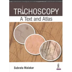 Trichoscopy