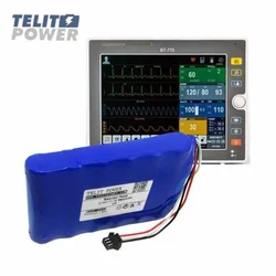 Telit power baterija li-ion 11.1v 5800mah lg( p-2397 ) za bitos bt-740 pacijent monitor