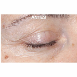 Germaine De Capuccini Timexpert Rides Eyes Contour Global Treatment