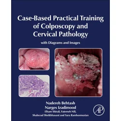 Case-Based Practical Training of Colposcopy and Cervical Pathology