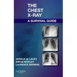 Chest X-Ray: A Survival Guide