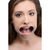 Gag Cheek Retractor