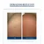 Eucerin® UreaRepair PLUS Pena za Stopala 10% Uree