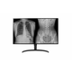 Monitor LG 80 cm (31,5) 32HL512D-B 3840x2160 Medicina IPS 5ms HDMI 2xDisplayPort 2xUSB2.0 Pivot  3H DCI-P3-98% HDR10 Diagnostic 4/6/8MP - CR, CT, Endoscopy