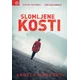 Slomljene kosti
