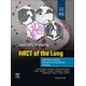 Specialty Imaging: HRCT of the Lung