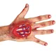 Guirca Brazgotina - poškodba na roki