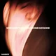 Hammok - When Does This Place Become Our Scene (CD)